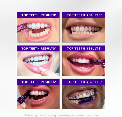 NOVA Purple Teeth Whitening Strips